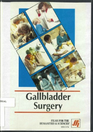 Gallbladder surgery