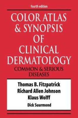 Color atlas and synopsis of clinical dermatology : common and serious diseases /