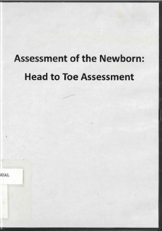 Assessment of the newborn : head to toe assessment